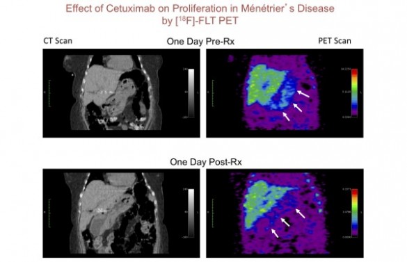 MDimage abnormal stomach tissue scans