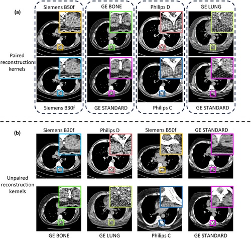 Vanderbilt University