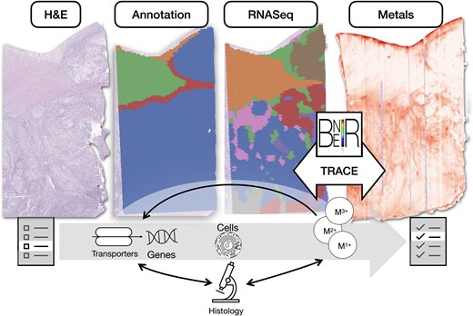 Vanderbilt University