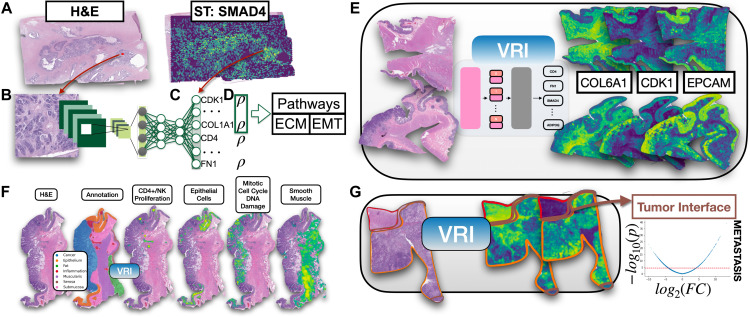 Vanderbilt University