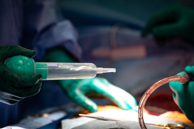 A standard heart transplant requires surgical many types of instruments. (photo by Erin O. Smith)