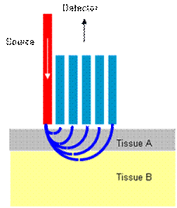 breast tumor margins