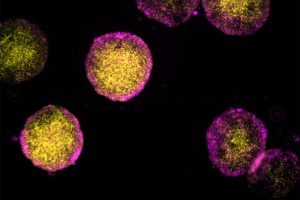 Vanderbilt University