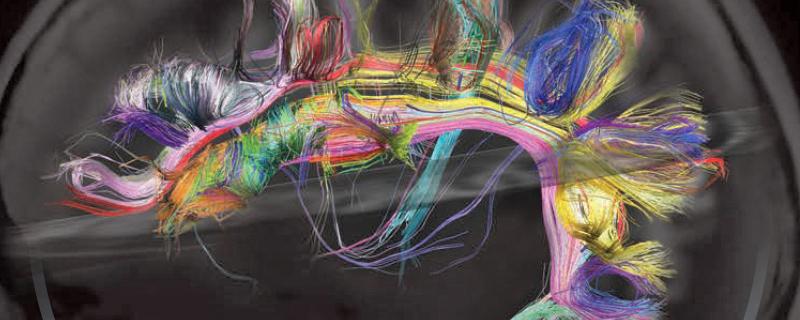 Map of the wiring diagram of specific brain circuits, now called the 'connectome' in the human brain.
